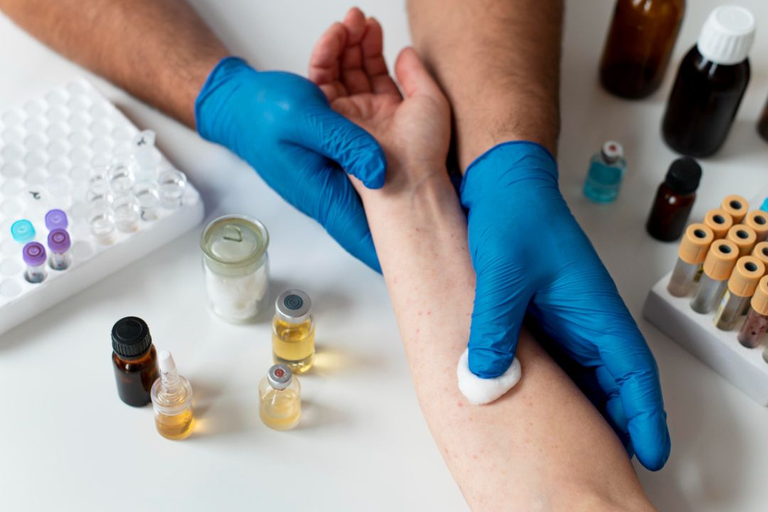 unraveling allergy triggers proven ways to stay safe